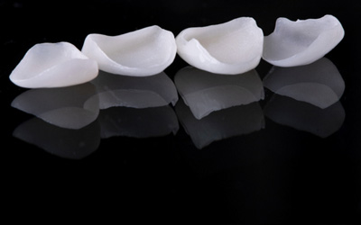 Four veneers sitting in a row on reflective surface